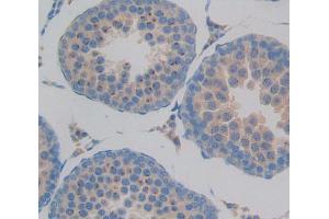 Used in DAB staining on fromalin fixed paraffin- embedded Kidney tissue (GMFB 抗体  (AA 2-142))