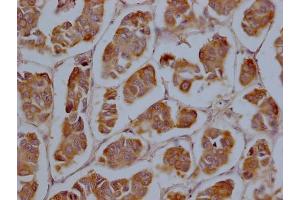 Immunohistochemistry (IHC) image for anti-Cytochrome P450, Family 2, Subfamily A, Polypeptide 13 (CYP2A13) (AA 252-354) antibody (ABIN7149222)