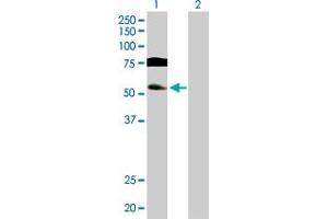 Western Blot analysis of GTF2A1L expression in transfected 293T cell line by GTF2A1L MaxPab polyclonal antibody. (GTF2A1L 抗体  (AA 1-478))