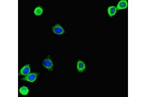 Immunofluorescent analysis of HepG2 cells using ABIN7166091 at dilution of 1:100 and Alexa Fluor 488-congugated AffiniPure Goat Anti-Rabbit IgG(H+L) (MBTPS1 抗体  (AA 17-70))