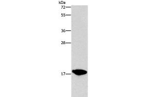 Western Blot analysis of HepG2 cell using CCL16 Polyclonal Antibody at dilution of 1:760 (CCL16 抗体)