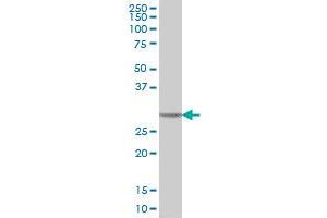 CA1 monoclonal antibody (M05), clone M1 Western Blot analysis of CA1 expression in HeLa . (CA1 抗体  (AA 1-261))
