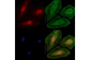 ABIN7094705 and ABIN7098756 staining  cells by IF/ICC. (PHAP1 抗体  (C-Term))