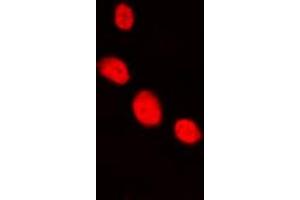 Immunofluorescent analysis of LHX1 staining in HepG2 cells. (LHX1 抗体  (Center))