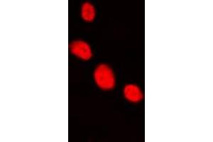 Immunofluorescent analysis of LHX1 staining in HepG2 cells. (LHX1 抗体  (Center))