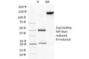 SDS-PAGE Analysis Purified CD56 Monoclonal Antibody (NCAM1/784). (Plakophilin 1 抗体  (N-Term))