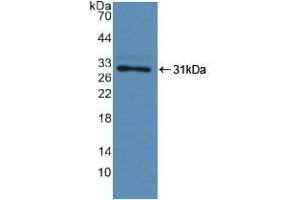 Detection of Recombinant F13A1, Human using Polyclonal Antibody to Coagulation Factor XIII A1 Polypeptide (F13A1) (F13A1 抗体  (AA 107-345))