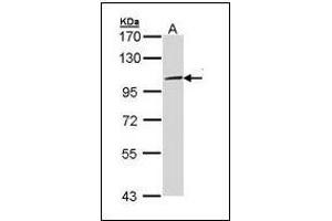 Sample (30 µg of whole cell lysate). (TLR3 抗体)