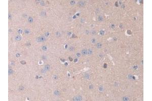 Detection of IL13Ra2 in Mouse Cerebrum Tissue using Polyclonal Antibody to Interleukin 13 Receptor Alpha 2 (IL13Ra2) (IL13RA2 抗体  (AA 228-338))