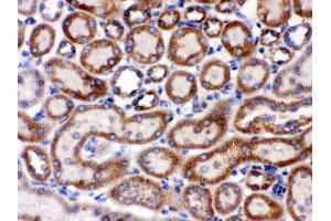 Anti- Grp75 Picoband antibody,IHC(P) IHC(P): Rat Kidney Tissue (HSPA9 抗体  (C-Term))