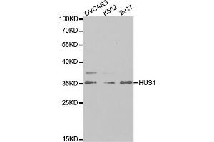 Western blot analysis of extracts of various cell lines, using HUS1 antibody (ABIN5973136) at 1/1000 dilution. (HUS1 抗体)