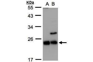 WB Image Sample(30 ug whole cell lysate) A:293T B:Raji , 12% SDS PAGE antibody diluted at 1:1000 (CBFB 抗体)