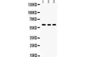Western Blotting (WB) image for anti-V-Yes-1 Yamaguchi Sarcoma Viral Oncogene Homolog 1 (YES1) (AA 7-35), (N-Term) antibody (ABIN3042333) (YES1 抗体  (N-Term))