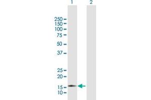 Western Blot analysis of ZMAT4 expression in transfected 293T cell line by ZMAT4 MaxPab polyclonal antibody. (ZMAT4 抗体  (AA 1-153))