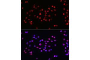 Immunofluorescence analysis of PC-12 cells using Acetyl-Histone H3-K27 Rabbit mAb (ABIN3016650, ABIN3016651, ABIN3016652, ABIN1682513 and ABIN1682514) at dilution of 1:100 (40x lens). (Histone 3 抗体  (acLys27))