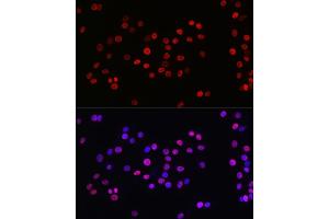 Immunofluorescence analysis of PC-12 cells using Acetyl-Histone H3-K27 Rabbit mAb (ABIN3016650, ABIN3016651, ABIN3016652, ABIN1682513 and ABIN1682514) at dilution of 1:100 (40x lens). (Histone H3 (Acetyl K27) (acLys27) 抗体)