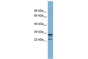 WB Suggested Anti-CUTC Antibody Titration: 0. (CUTC 抗体  (Middle Region))