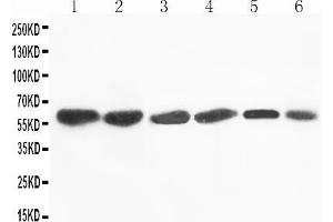 Anti-Flavin containing monooxygenase 4 antibody, Western blotting Lane 1: Rat Liver Tissue Lysate Lane 2: Mouse Liver Tissue Lysate Lane 3: SMMC Cell Lysate Lane 4: HEPA Cell Lysate Lane 5: A431 Cell Lysate Lane 6: MCF-7 Cell Lysate (FMO4 抗体  (N-Term))
