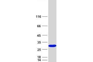 SSSCA1 Protein (Myc-DYKDDDDK Tag)