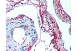 Anti-Elastin antibody IHC of human skeletal muscle, vessels. (Elastin 抗体)