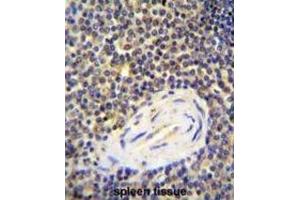 Immunohistochemistry (IHC) image for anti-ArfGAP with Coiled-Coil, Ankyrin Repeat and PH Domains 1 (ACAP1) antibody (ABIN2996040) (ACAP1 抗体)