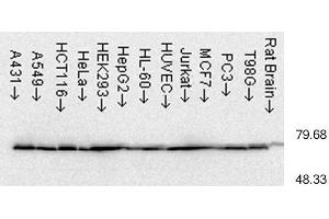 Image no. 1 for anti-Heat Shock Protein 70 (HSP70) antibody (ABIN361708)