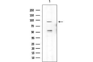 anti-RNA Binding Motif Protein 12 (RBM12) antibody