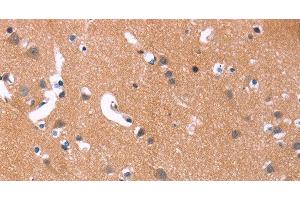 Immunohistochemistry of paraffin-embedded Human brain using MAPK11 Polyclonal Antibody at dilution of 1:30