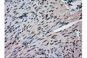 Immunohistochemical staining of paraffin-embedded pancreas tissue using anti-MAPK1mouse monoclonal antibody. (ERK2 抗体)