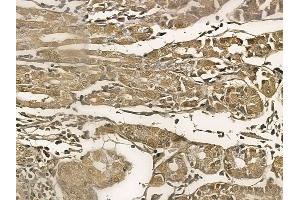 KLHL4 Mouse Monoclonal Antibody at 1/100 staining human normal gastric tissue by IHC-P. (Kelch-Like 4 抗体)