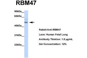 Host: Rabbit  Target Name: RBM47  Sample Tissue: Human Fetal Lung  Antibody Dilution: 1. (RBM47 抗体  (Middle Region))