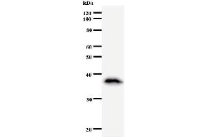 Western Blotting (WB) image for anti-Matrin 3 (MATR3) antibody (ABIN933126) (MATR3 抗体)
