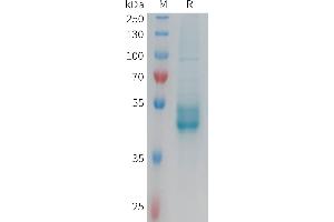 SDS-PAGE (SDS) image for Interleukin 25 (IL25) (AA 33-177) protein (Fc Tag) (ABIN7538342)