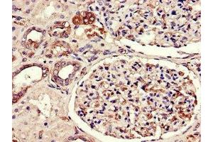 Immunohistochemistry of paraffin-embedded human kidney tissue using ABIN7175380 at dilution of 1:100