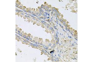 Immunohistochemistry of paraffin-embedded human prostate using PPIC antibody. (PPIC 抗体)