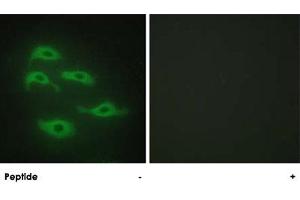 Immunofluorescence analysis of HepG2 cells, using SERINC3 polyclonal antibody . (SERINC3 抗体  (C-Term))