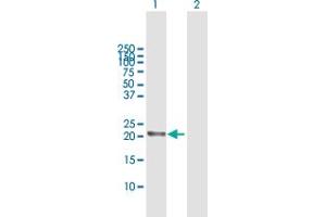 Western Blot analysis of RGS5 expression in transfected 293T cell line by RGS5 MaxPab polyclonal antibody.