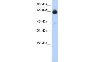 IGFALS antibody used at 1 ug/ml to detect target protein. (IGFALS 抗体  (Middle Region))