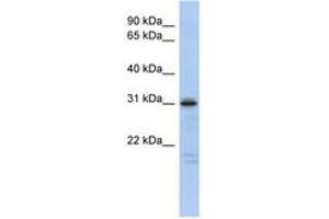 Image no. 1 for anti-Homeobox D9 (HOXD9) (AA 143-192) antibody (ABIN6742472) (HOXD9 抗体  (AA 143-192))
