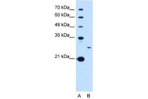 Tetraspanin 15 antibody used at 1 ug/ml to detect target protein. (Tetraspanin 15 抗体  (C-Term))