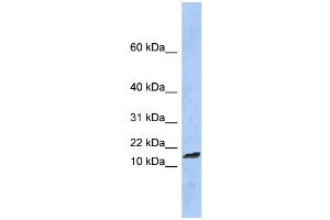 WB Suggested Anti-TAL2 Antibody Titration:  0. (TAL2 抗体  (Middle Region))