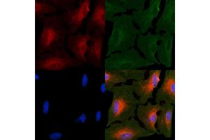 ABIN6264142 and ABIN6266623 staining  cells by IF/ICC. (Peripherin 抗体  (C-Term))