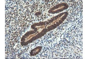 Image no. 11 for anti-Leucine Zipper and CTNNBIP1 Domain Containing (LZIC) antibody (ABIN1499239)