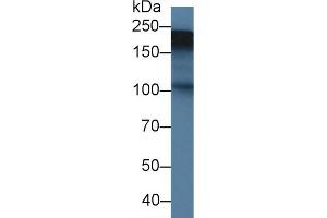 Detection of TNC in Rat Placenta lysate using Polyclonal Antibody to Tenascin C (TNC) (TNC 抗体  (AA 513-621))