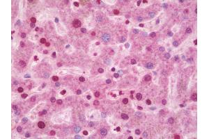 Anti-CIDEA / CIDE-A antibody IHC staining of human liver. (CIDEA 抗体  (AA 181-209))