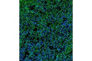 Immunofluorescence (IF) image for anti-Interleukin 2 Receptor, gamma (IL2RG) (AA 76-101), (N-Term) antibody (ABIN653403)