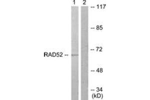 Western blot analysis of extracts from A549 cells, treated with EGF 200ng/ml 30', using DRP-2 (Ab-514) Antibody. (DRP2 抗体  (AA 480-529))
