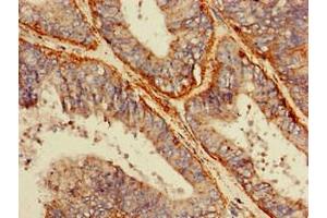 Immunohistochemistry (IHC) image for anti-Scavenger Receptor Class B, Member 2 (SCARB2) (AA 47-128) antibody (ABIN7158800)