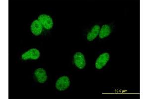 Immunofluorescence of monoclonal antibody to CAND1 on HeLa cell. (CAND1 抗体  (AA 1-100))