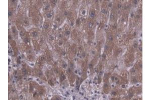 Detection of CES1 in Human Liver Tissue using Polyclonal Antibody to Carboxylesterase 1 (CES1) (CES1 抗体  (AA 18-299))